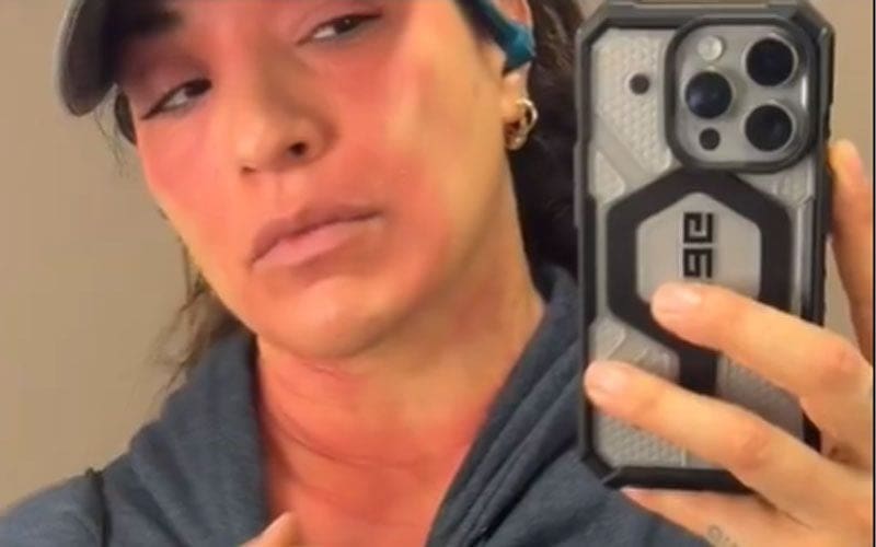 Raquel Rodriguez Chronicles Healing Journey After Mast Cell Activation Syndrome Diagnosis