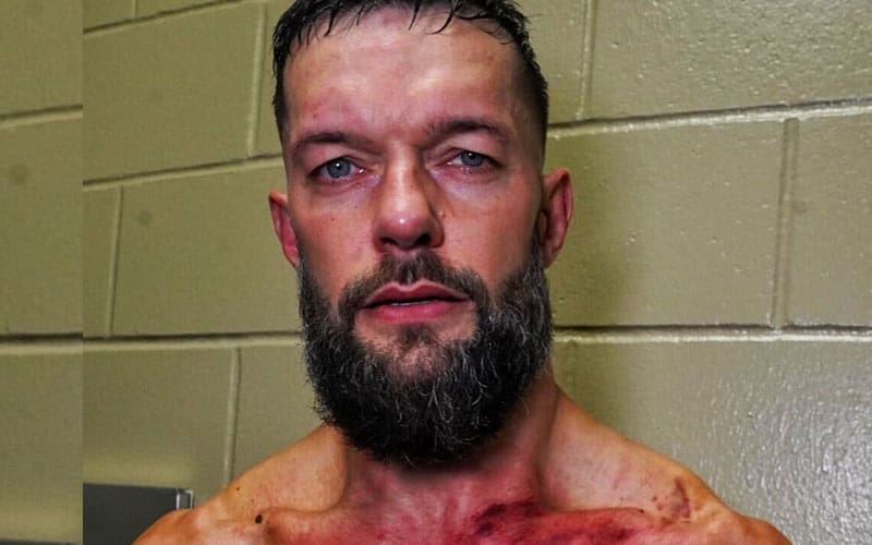 Finn Balor Shows Off Brutal Aftermath of GUNTHER’s Offense After 7/29 WWE RAW